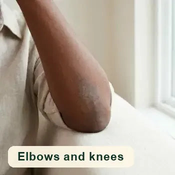Elbows and knees