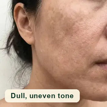 Dull, uneven tone