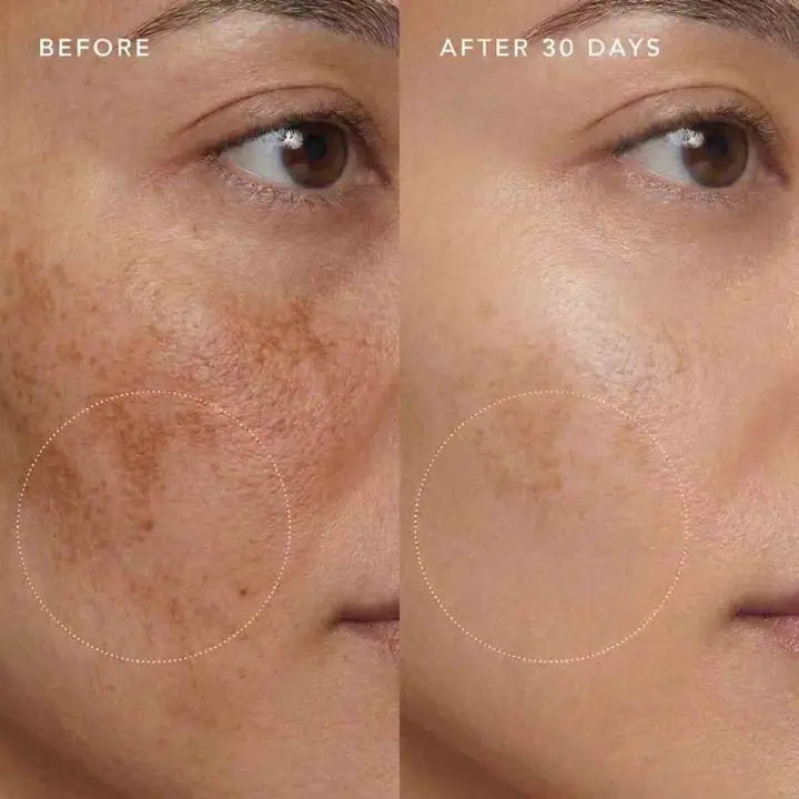 Before and after 30 days with Kumkumadi oil